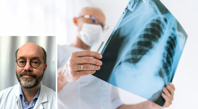Diagnostik förbättrar lungcancerpatienters prognos